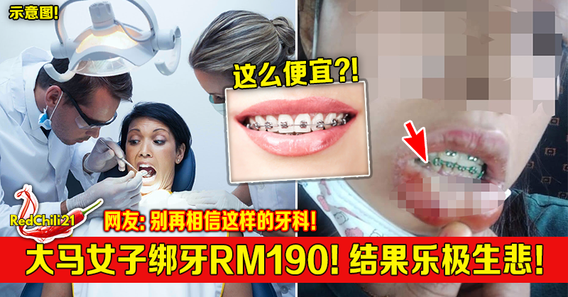 大马女子绑牙rm190 结果乐极生悲 Redchili21